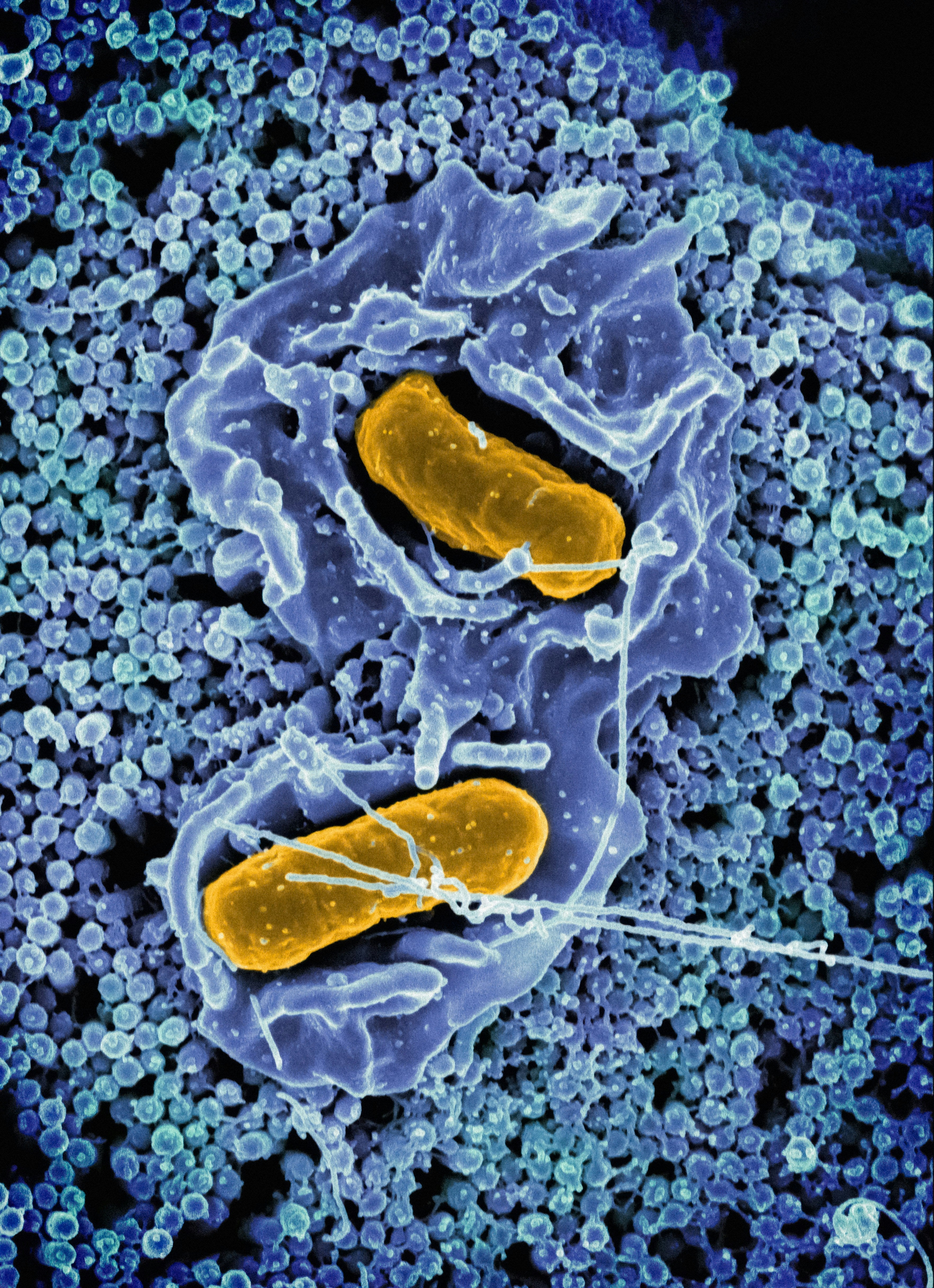 How to Naturally Cleanse Parasites From Your Body: A Complete Guide