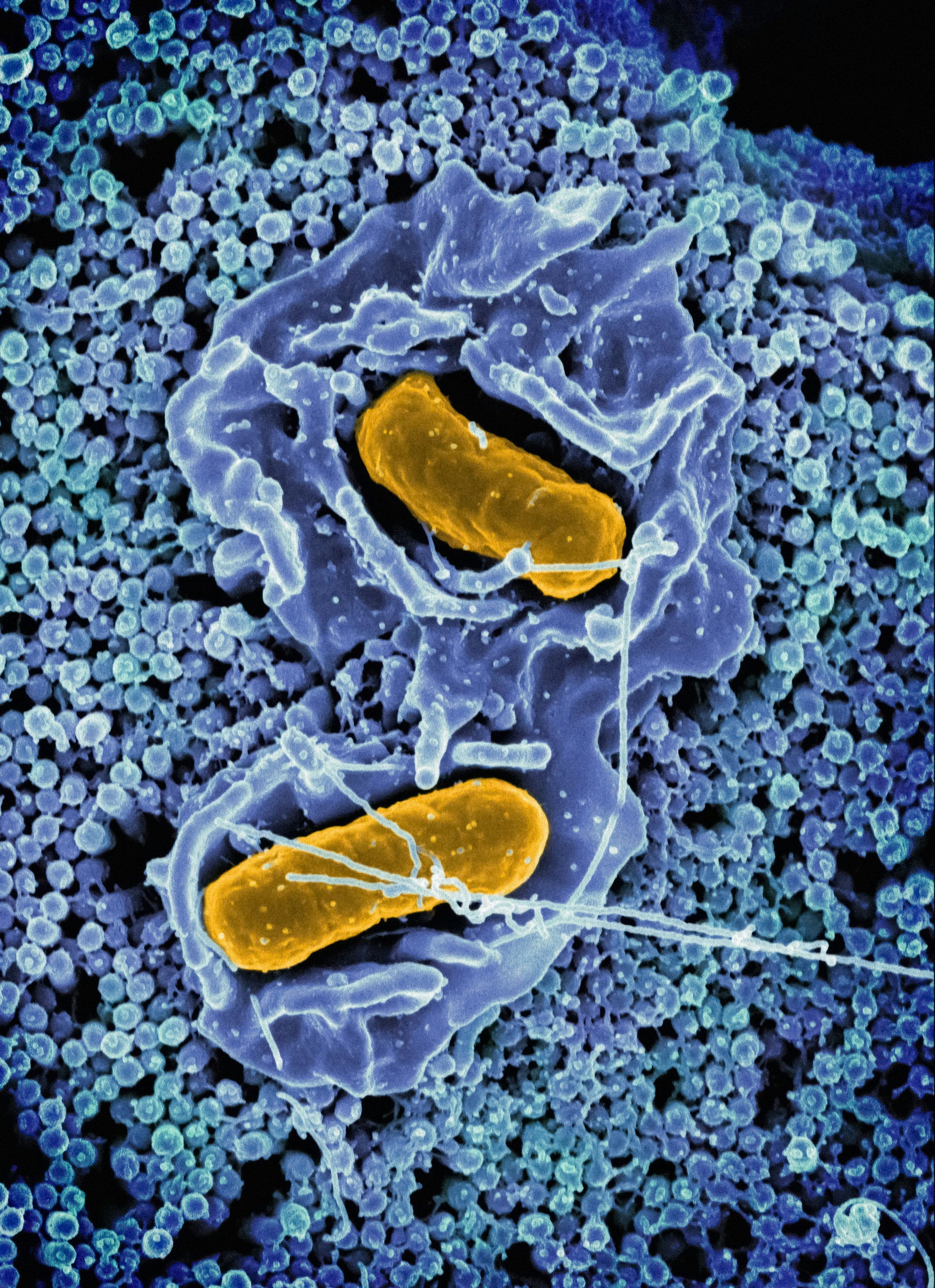 How to Naturally Cleanse Parasites From Your Body: A Complete Guide